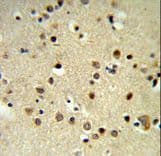 CBX1 / HP1 Beta Antibody (aa128-155)