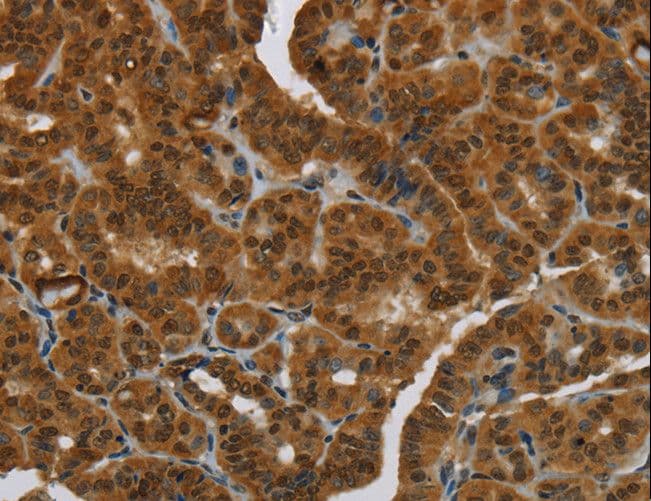 MRE11A / MRE11 Antibody