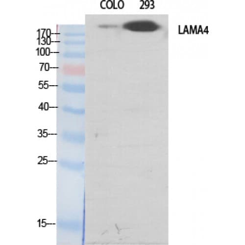 LAMA4 / Laminin Alpha 4 Antibody (450-530 aa, Internal)