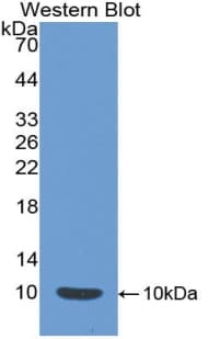 EMA / MUC1 Antibody (aa410-525)