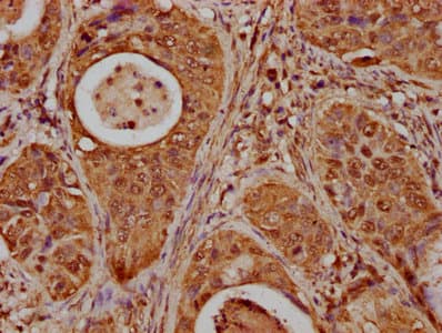 HIST1H1E Antibody