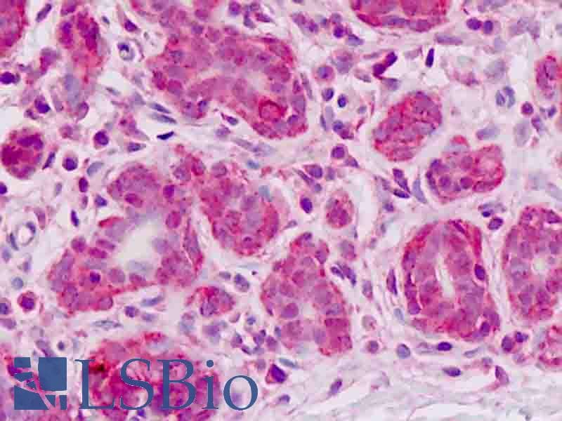 IHC-plus™ ESYT2 / E-Syt2 Antibody (clone 1E10)