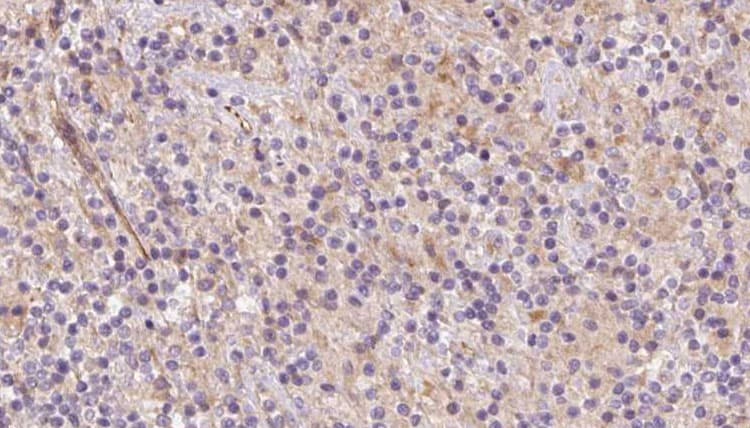 SYVN1 / HRD1 Antibody