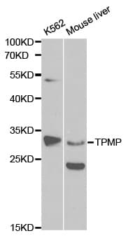 TPMT Antibody