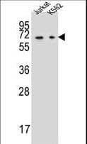 DPYS / Dihydropyrimidinase Antibody (aa454-482)