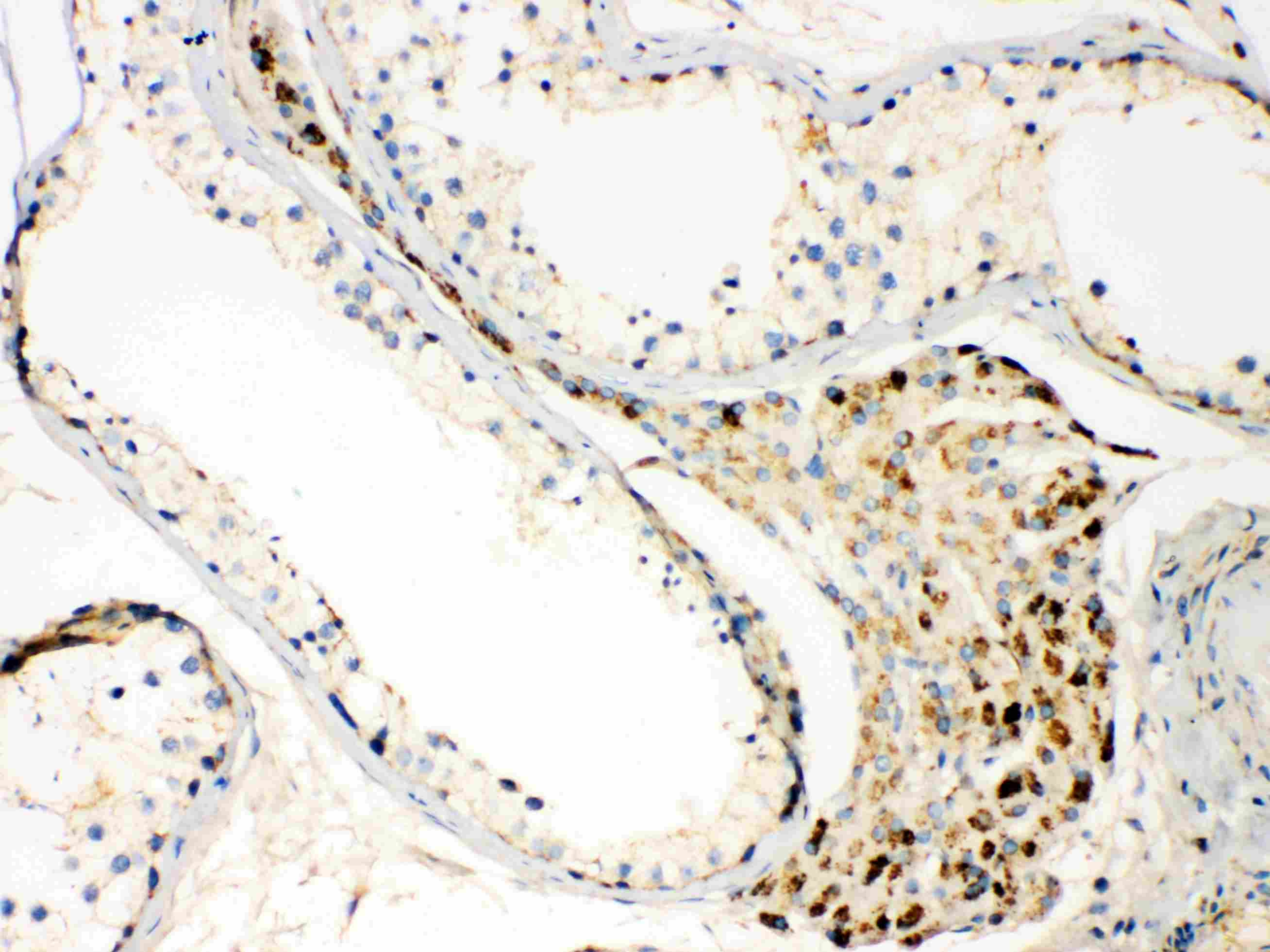 Polyclonal Rabbit anti-Human TECTA Antibody (IHC, WB)