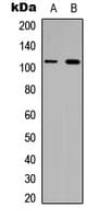 COL6A1 / Collagen VI Alpha 1 Antibody (Internal)
