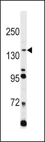 IHC-plus™ L1CAM Antibody (aa1154-1182)