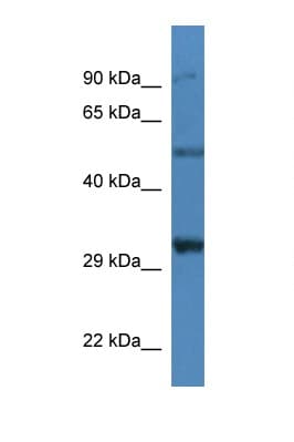 SGCD / Delta-Sarcoglycan Antibody (aa37-86)