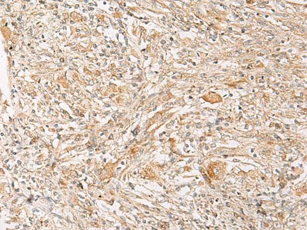 GPR22 Antibody
