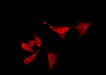 Polyclonal Rabbit anti-Human OR6S1 Antibody (IF, WB)