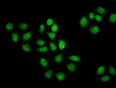 Polyclonal Rabbit anti-Human MCM3AP / GANP Antibody (IHC)