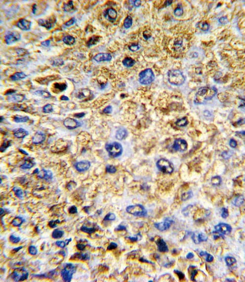 Polyclonal Rabbit anti-Human DCN / Decorin Antibody (aa122-150, IHC, WB)