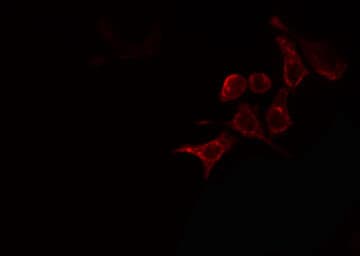ARSI / Arylsulfatase I Antibody