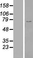 ZNF667 / MIPU1 Protein (Over-Expression Lysate Myc-DDK (Flag))