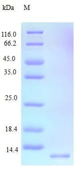 Human CCL15 / MIP5 Protein (Recombinant)