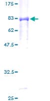 Human PEPD / PROLIDASE Protein (Recombinant GST)