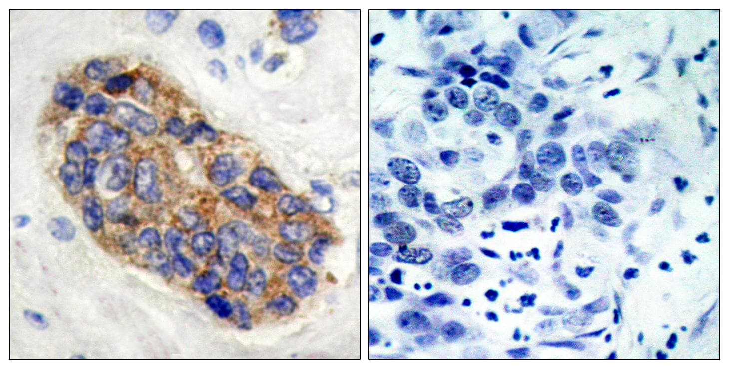 Polyclonal Rabbit anti-Human MYC / c-Myc Antibody (p373, IHC, WB)