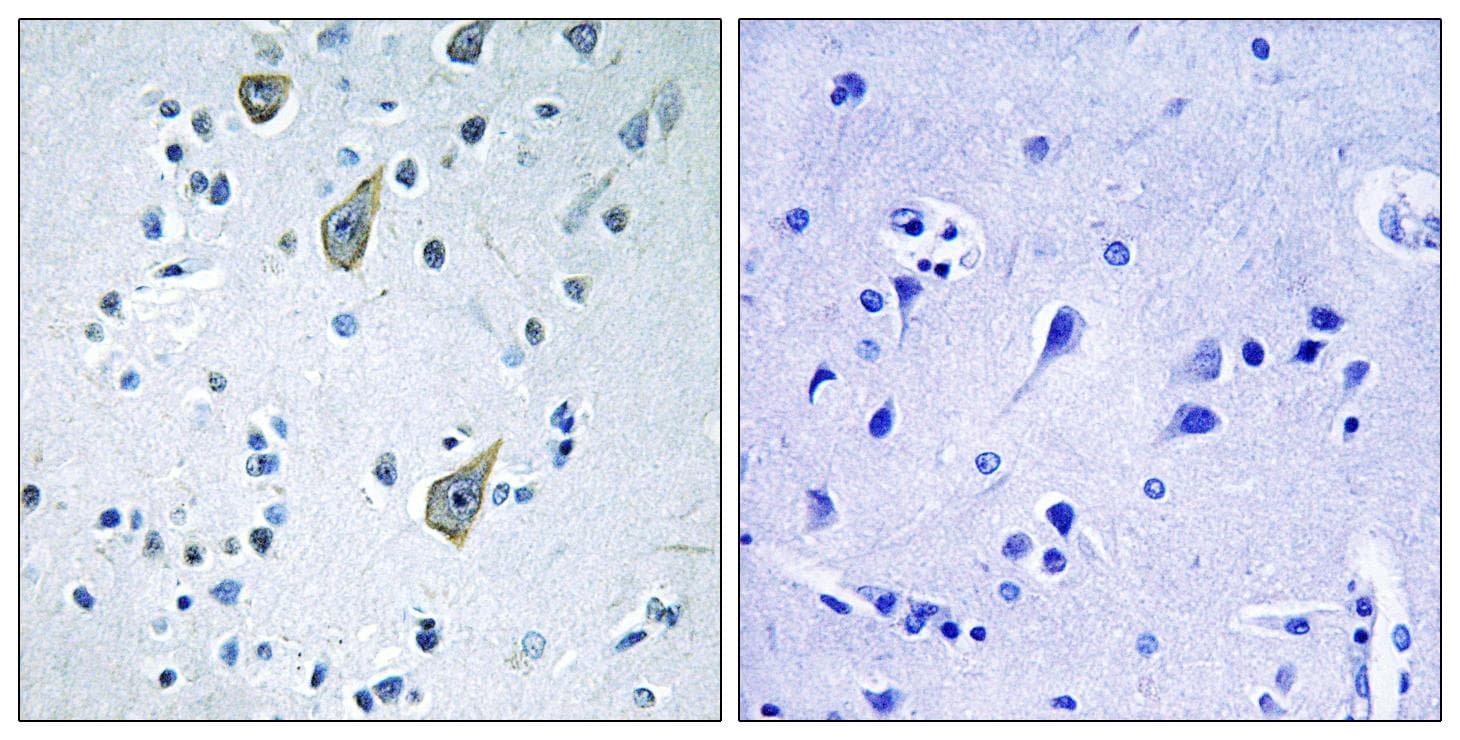 FZD6 / Frizzled 6 Antibody