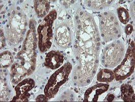 RAB21 Antibody (clone OTI6G1)