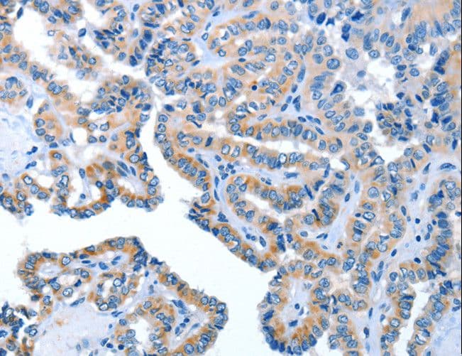 Polyclonal Rabbit anti-Human AMDHD2 Antibody (IHC, WB)
