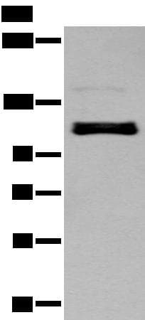Polyclonal Rabbit anti-Human ZNF281 / Zfp281 Antibody (IHC, WB)