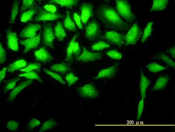 Monoclonal Mouse anti-Human CKS2 Antibody (clone 2H5-2C4, IF, WB)