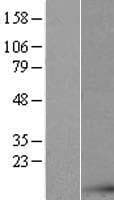 AKAP7 Protein (Over-Expression Lysate Myc-DDK (Flag))