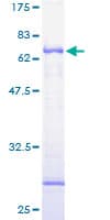 Human LYVE1 Protein (Recombinant GST)
