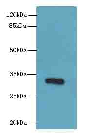 IHC-plus™ PPP1R3B Antibody