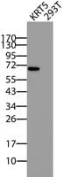 IHC-plus™ KRT5 / CK5 / Cytokeratin 5 Antibody (clone 4H8)