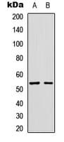 GLP1R / GLP-1 Receptor Antibody (Internal)