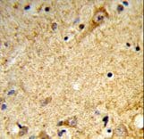 Polyclonal Rabbit anti-Human MARVELD2 / Tricellulin Antibody (aa386-415, IHC, WB)