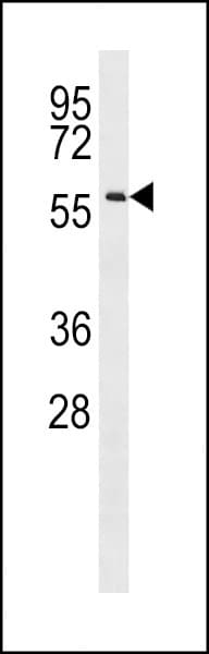 CCDC155 Antibody (aa159-185)