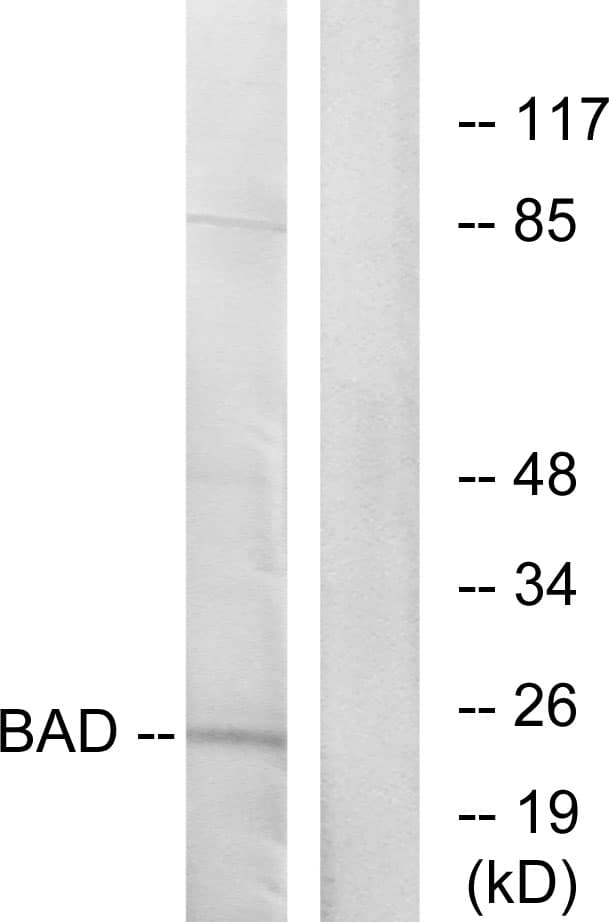 PathPlus™ Polyclonal Rabbit anti-Human BAD Antibody (aa119-168, IHC, WB)