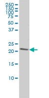 PRDX2 / Peroxiredoxin 2 Antibody (clone 4E10-2D2)