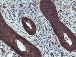 TIP48 / RUVBL2 Antibody (clone OTI1A6)