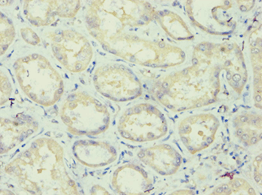 APOL1 / Apolipoprotein L Antibody (aa179-398)