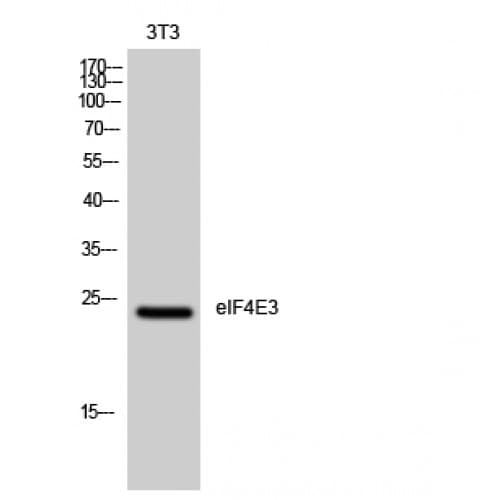 EIF4E3 Antibody (110-190 aa, Internal)