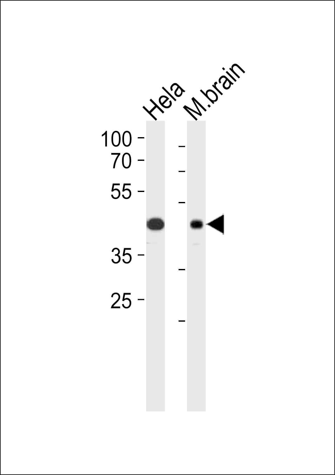PathPlus™ TDP-43 / TARDBP Antibody (aa1-30)