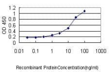 SARS / Serine-tRNA Ligase Antibody (clone 1H4)
