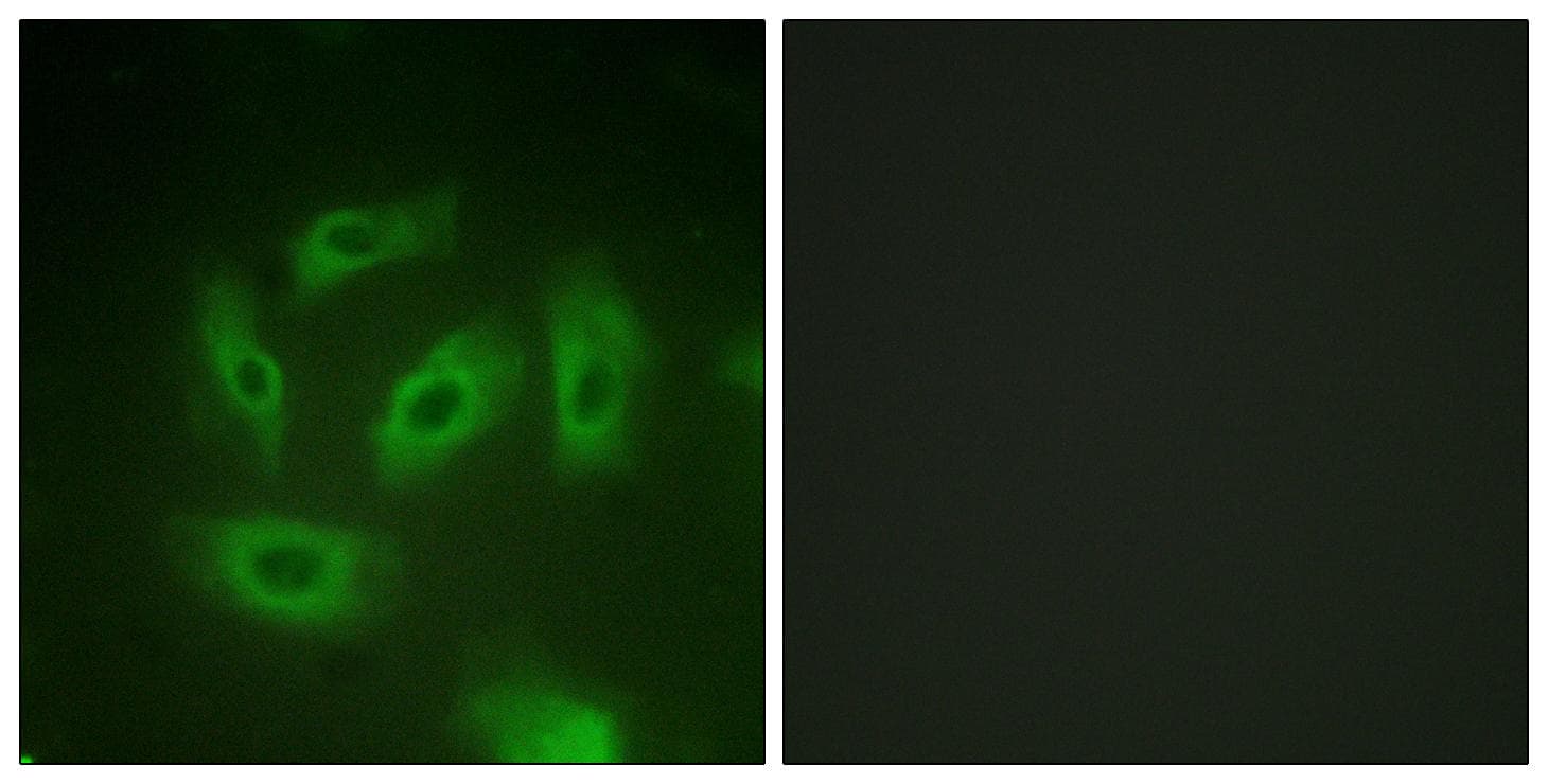 TGFBR1 / ALK5 Antibody (p165)