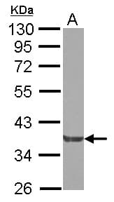 GRB4 / NCK2 Antibody