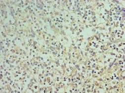 Polyclonal Rabbit anti-Human CD68 Antibody (aa22-319, IHC)
