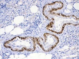 ACVR2 / ACVR2A Antibody
