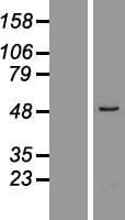 ZNF701 Protein (Over-Expression Lysate Myc-DDK (Flag))