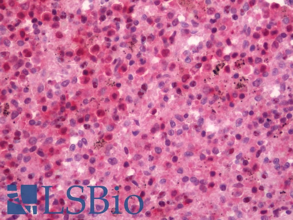 IHC-plus™ RELA / NFKB p65 Antibody (aa275-324)