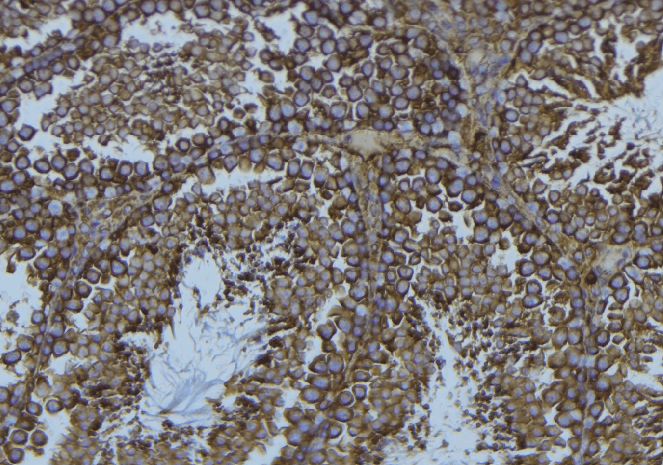 PFN1 / Profilin 1 Antibody