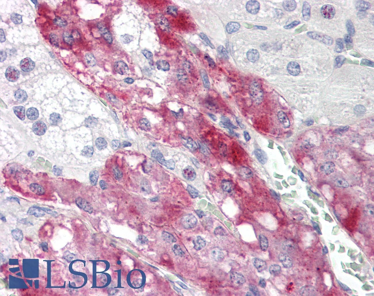 IHC-plus™ TCTEX1D4 Antibody