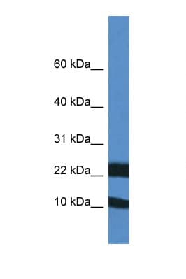 FXN / Frataxin Antibody (aa80-129)